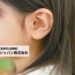 メドエルジャパン株式会社の企業研究｜人工内耳の専門企業で働く魅力